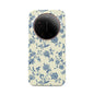 Sweetheart - Xiaomi 17 Ultra Case