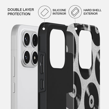 Sound Check - Xiaomi 17 Case