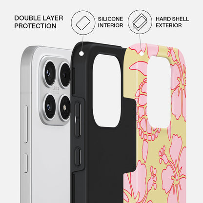 Tan Break - Xiaomi 17 Case