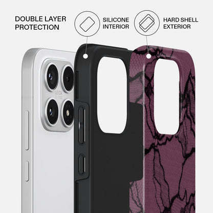 That Girl - Xiaomi 17 Case